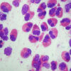 NasalCytoKit - Nasal cytology - Image 2