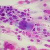NasalCytoKit - Nasal cytology - Image 3