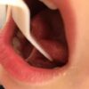 Tongue Lifter - Device for lingual frenulum - immagine 6